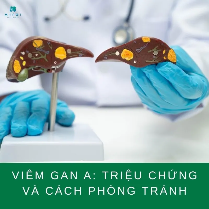 trieu-chung-viem-gan-a