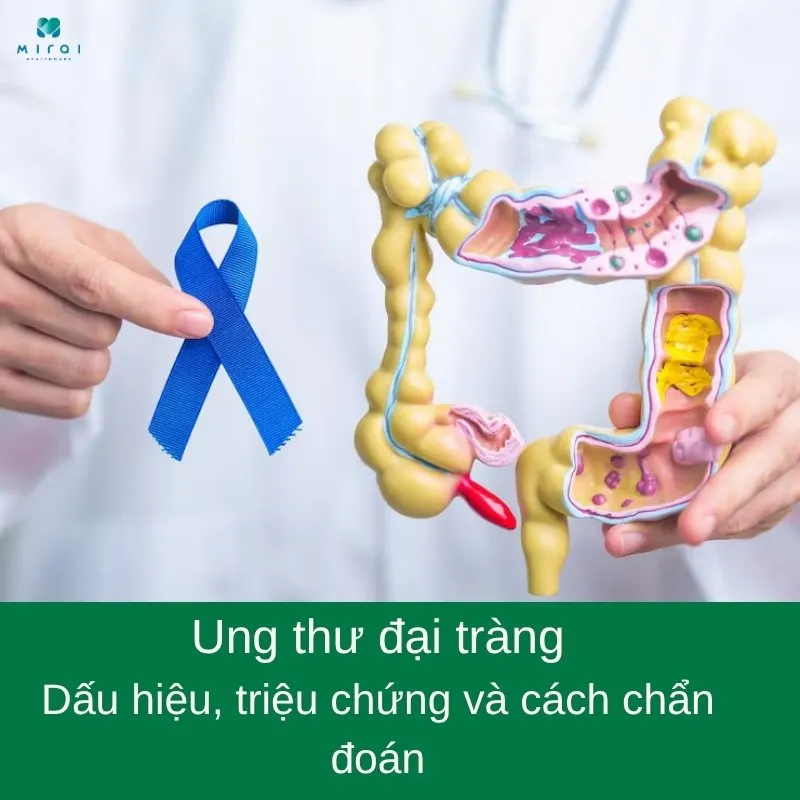 ung-thu-dai-trang
