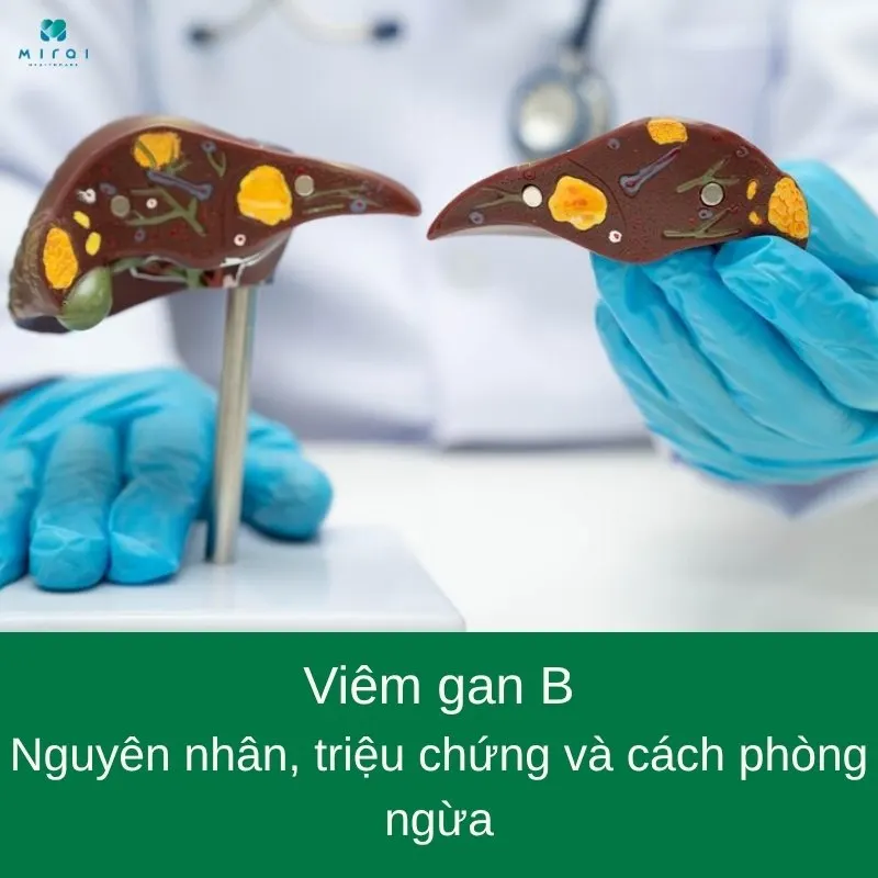 viem-gan-b