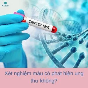 xet-nghiem-mau-co-phat-hien-ung-thu-khong