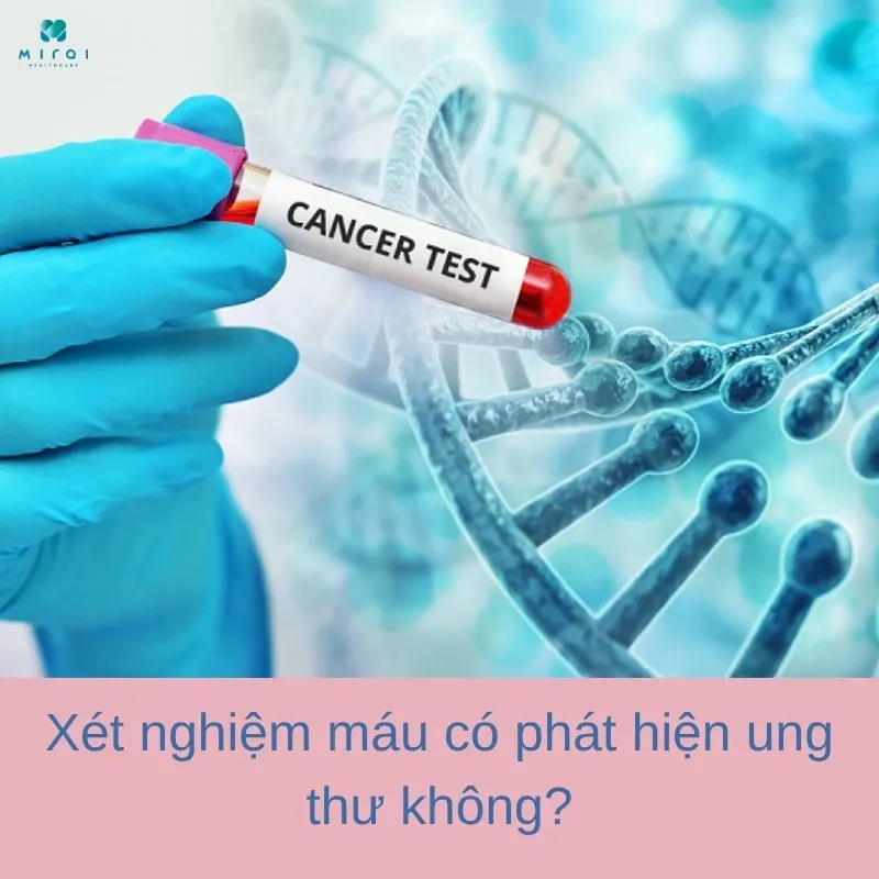 xet-nghiem-mau-co-phat-hien-ung-thu-khong
