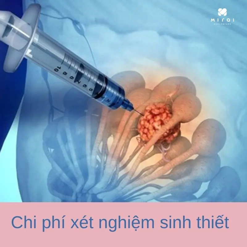 xet-nghiem-sinh-thiet-gia-bao-nhieu