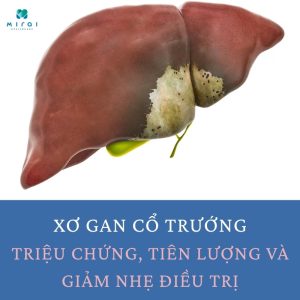 xo-gan-co-truong