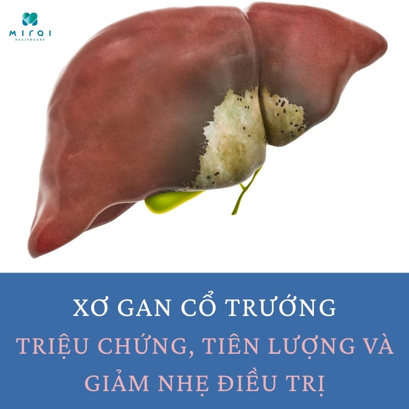 xo-gan-co-truong