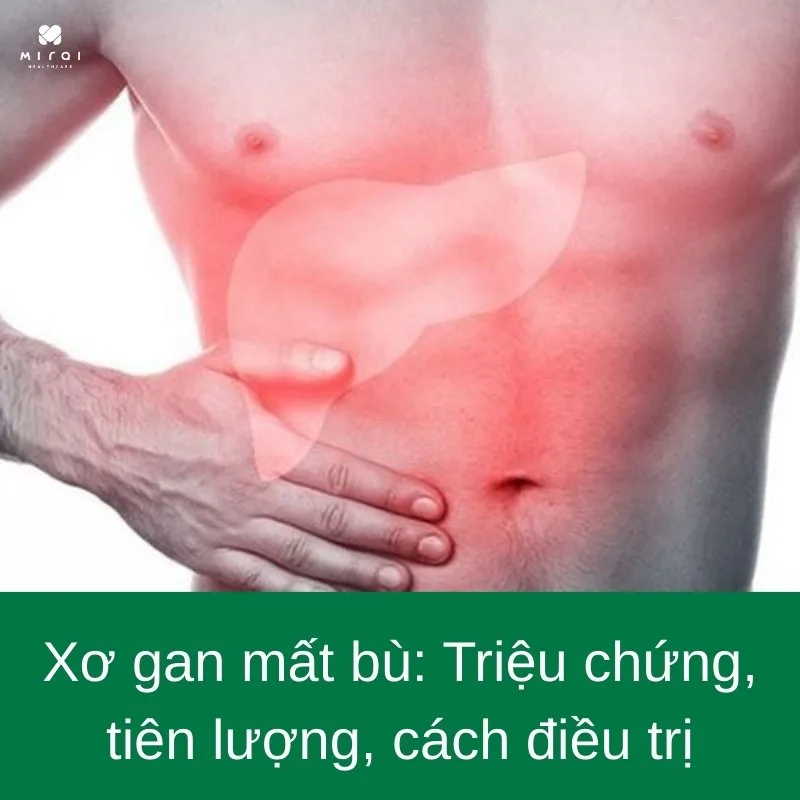 xo-gan-mat-bu