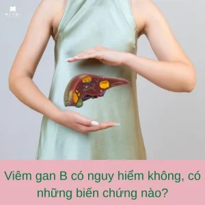 benh-viem-gan-b-co-nguy-hiem-khong