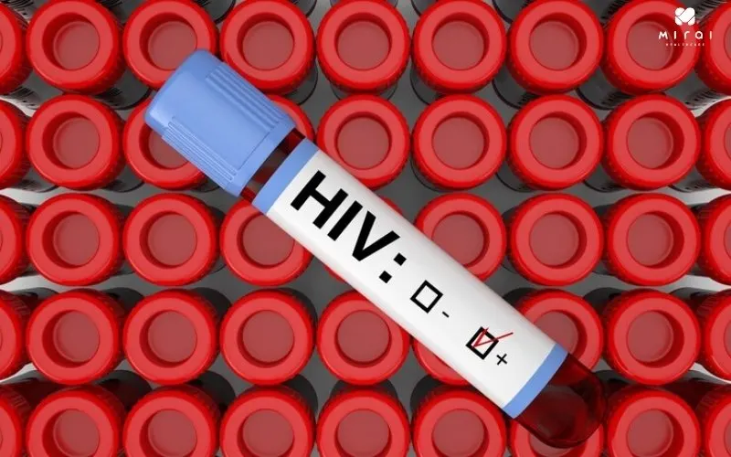 khong-can-nhin-an-khi-xet-nghiem-hiv