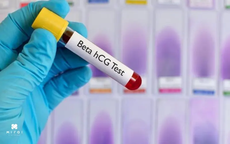 xet-nghiem-beta-hcg-khong-can-nhin-an-truoc-khi-lay-mau