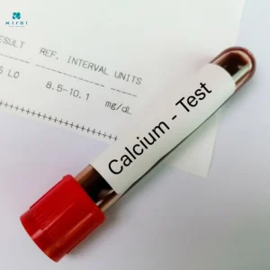 xet-nghiem-canxi-mau