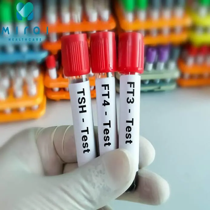 xet-nghiem-ft3-ft4-tsh