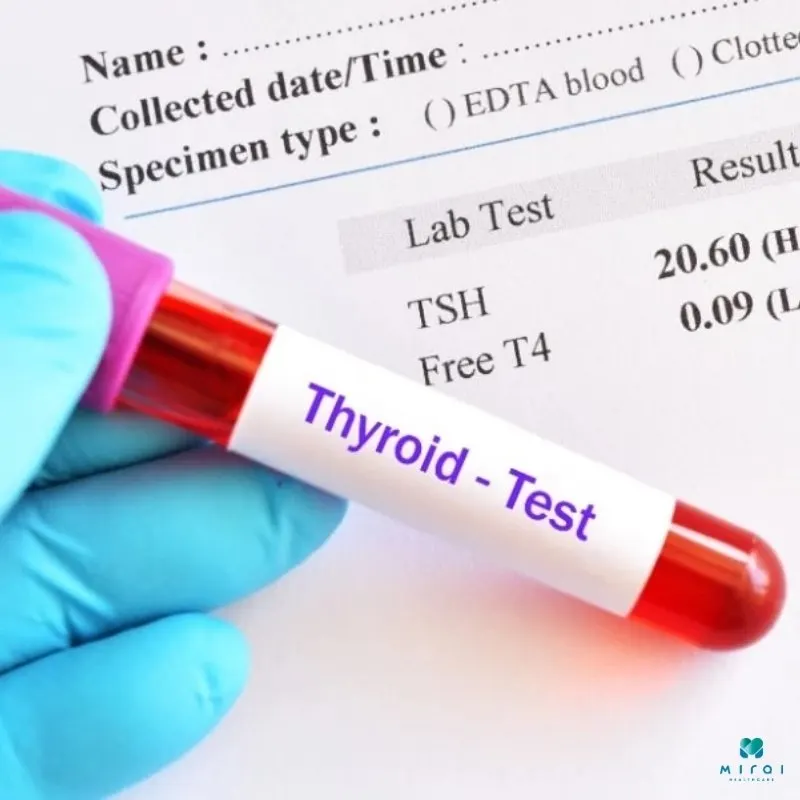 xet-nghiem-trab-tuyen-giap