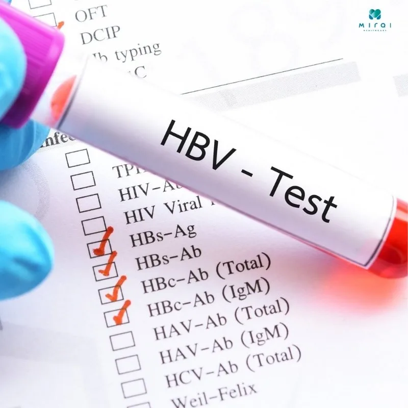 xet-nghiem-viem-gan-b-bao-nhieu-tien