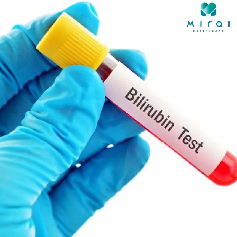 bilirubin-la-gi