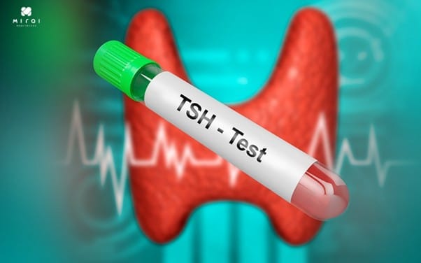 cac-phuong-phap-xet-nghiem-tam-soat-ung-thu-tuyen-giap-hormone-tuyen-giap-tsh