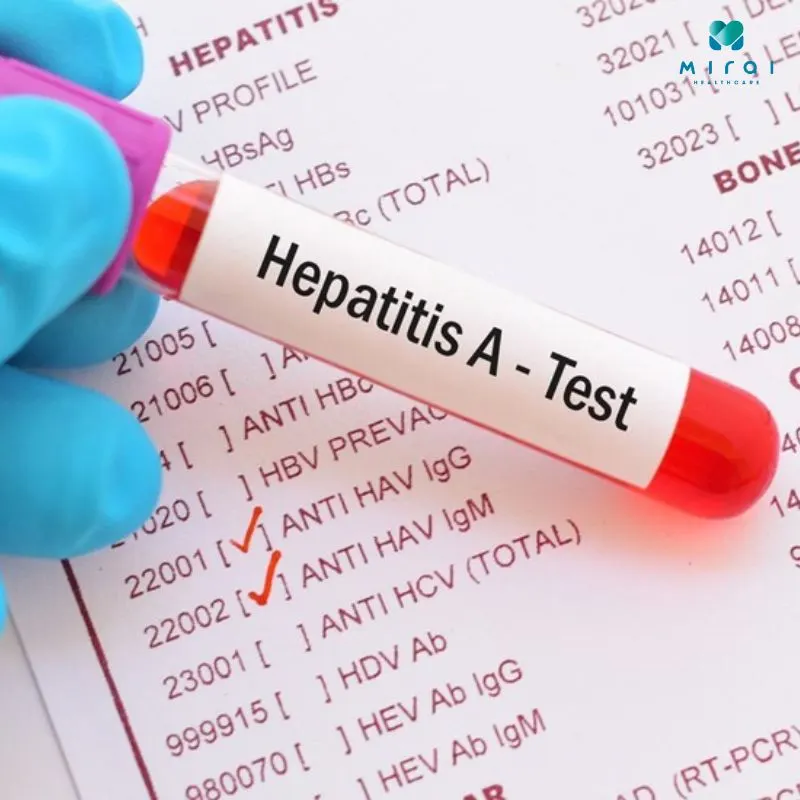 cac-xet-nghiem-viem-gan-a