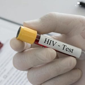 dich-vu-xet-nghiem-hiv-tai-nha-thumbnail