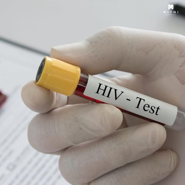 dich-vu-xet-nghiem-hiv-tai-nha-thumbnail