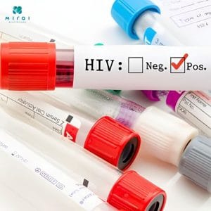 thoi-gian-xet-nghiem-hiv-thumbnail