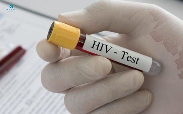 xet-nghiem-hiv-bao-nhieu-tien-PCR-HIV