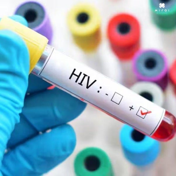 xet-nghiem-hiv-bao-nhieu-tien-thumbnail