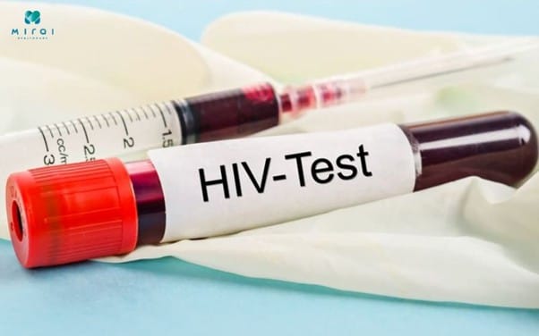 xet-nghiem-hiv-la-gi