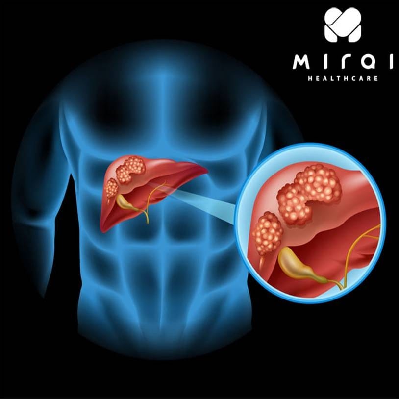 afp-l3-la-gi-thumbnail