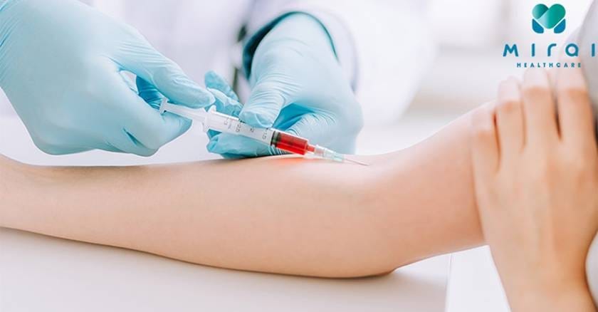 bilirubin-truc-tiep-cao-noi-len-dieu-gi