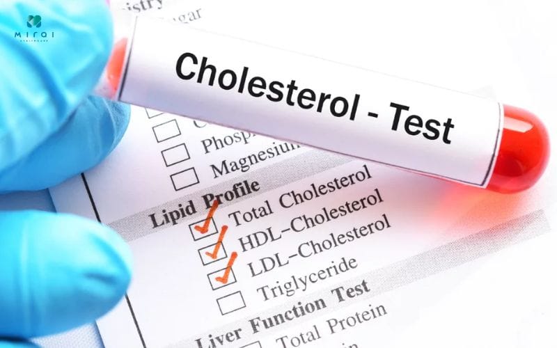 cac-chi-so-xet-nghiem-gan-nhiem-mo-01