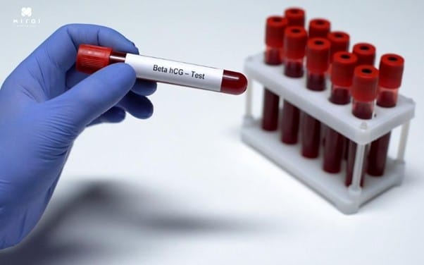 cac-chi-so-xet-nghiem-mau-cho-biet-co-thai-khong