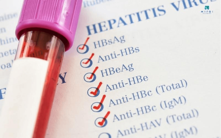 cac-chi-so-xet-nghiem-mau-phat-hien-viem-gan-b-hbsab-anti-hbs