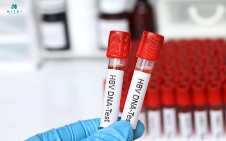 cac-chi-so-xet-nghiem-mau-phat-hien-viem-gan-b-hbv-dna