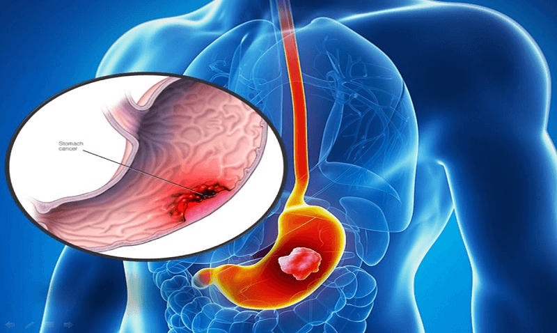 chi-dinh-lam-xet-nghiem-ca-72-4-khi-nao