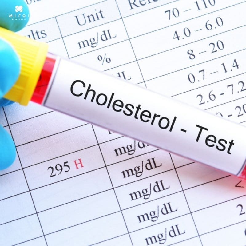 dinh-luong-cholesterol-toan-phan-thumbnail