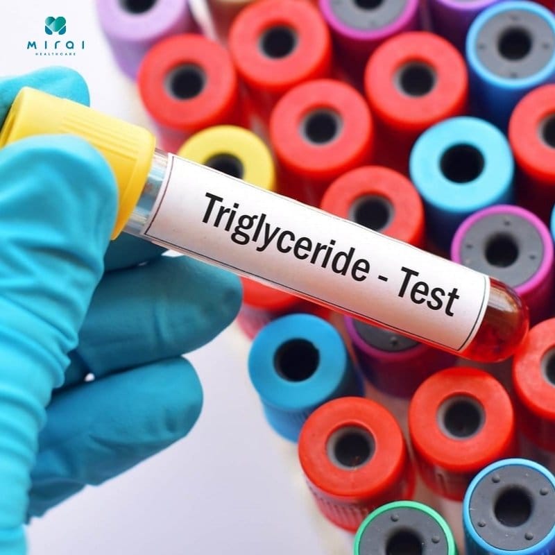 dinh-luong-triglycerid-thumbnail