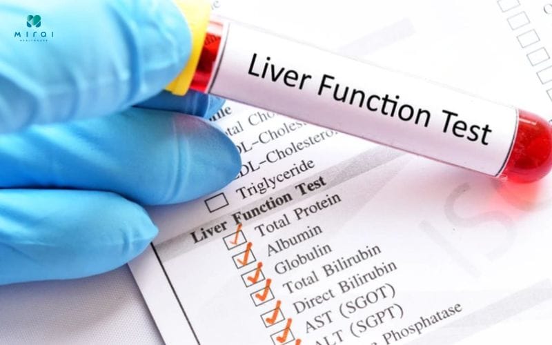 khi-nao-nen-lam-xet-nghiem-gan-nhiem-mo