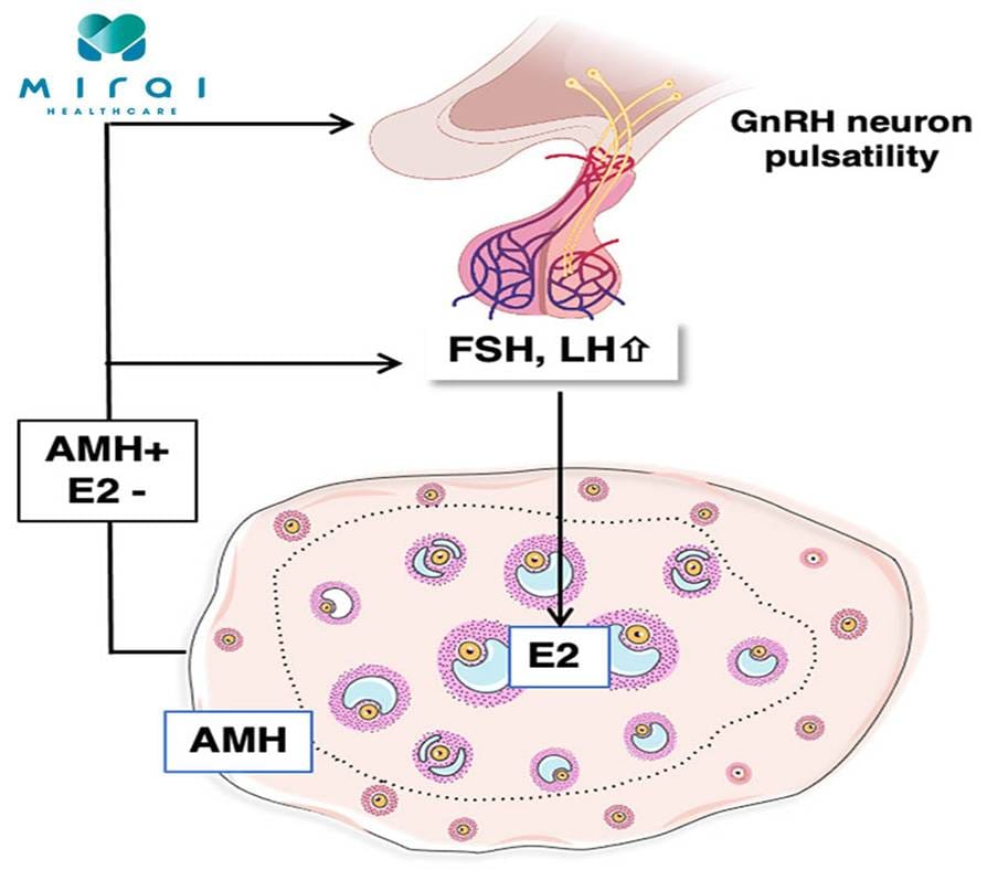 xet-nghiem-amh-la-gi