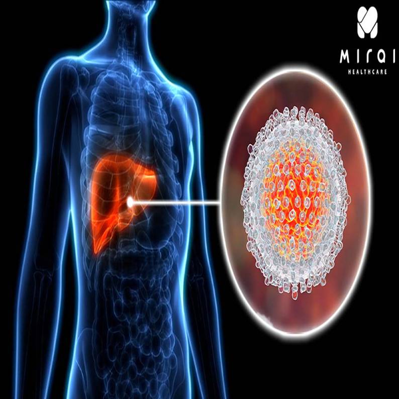 xet-nghiem-anti-hcv-la-gi-thumbnail