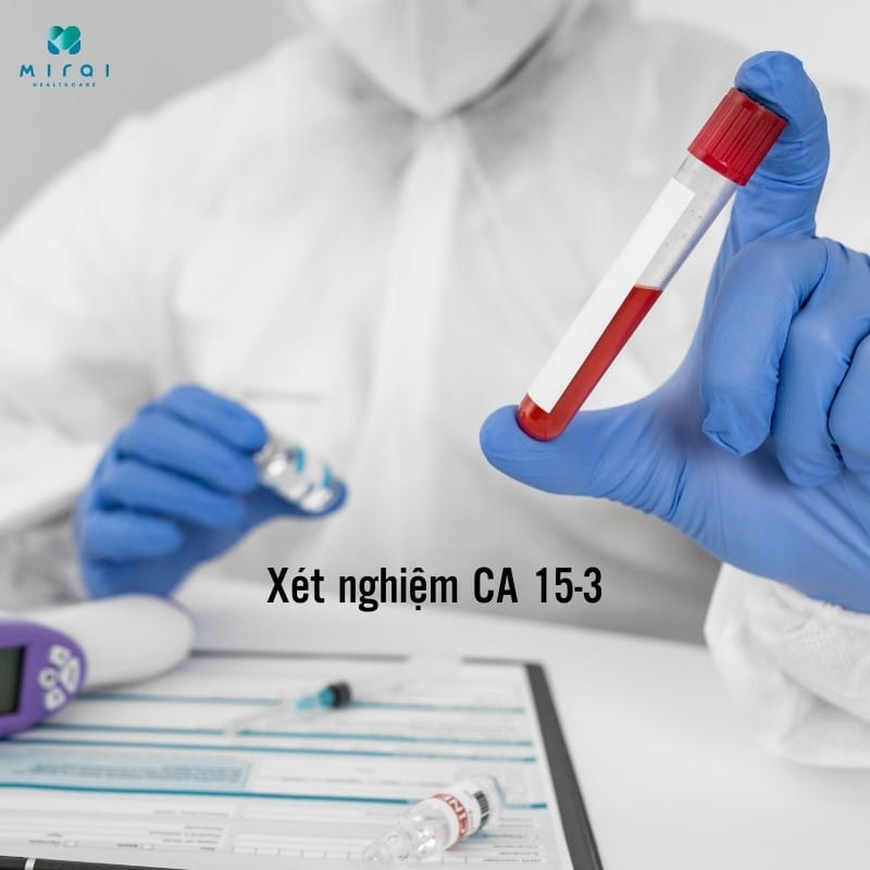 xet-nghiem-ca-15-3-thumbnail
