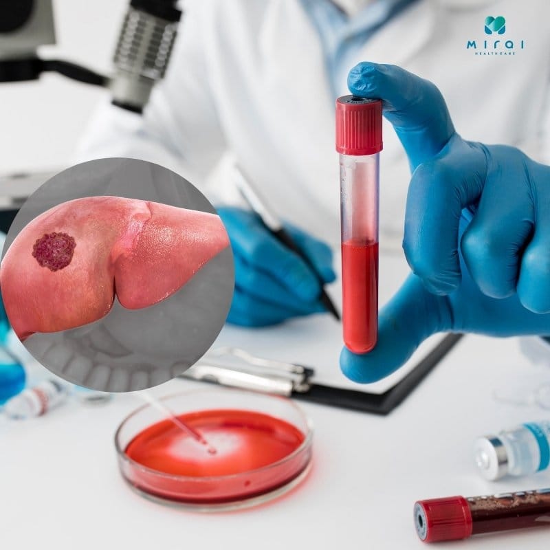 xet-nghiem-dcp-la-gi-thumbnail