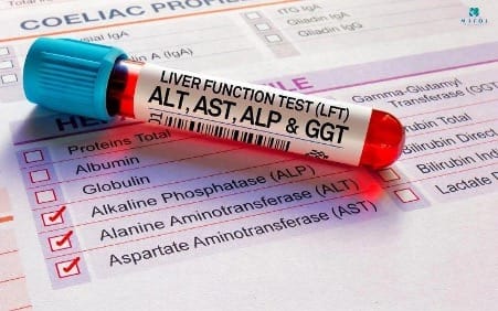 xet-nghiem-gan-co-can-nhin-an-khong