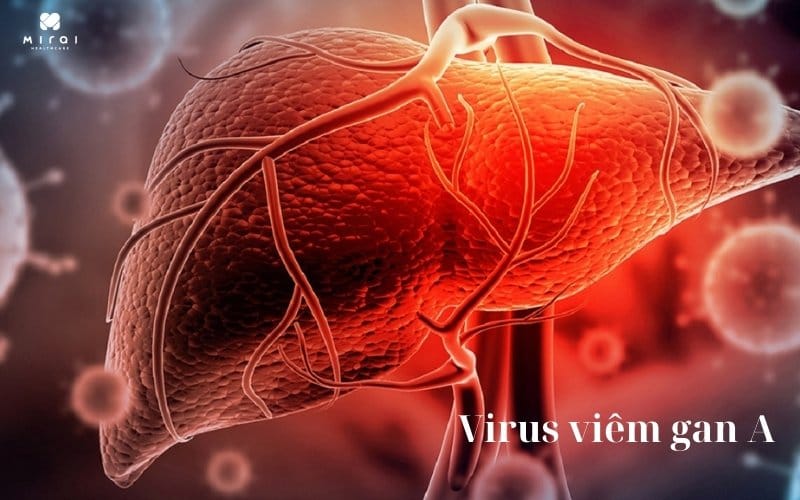 xet-nghiem-hav-la-gi