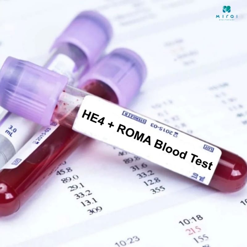 xet-nghiem-he4-thumbnail