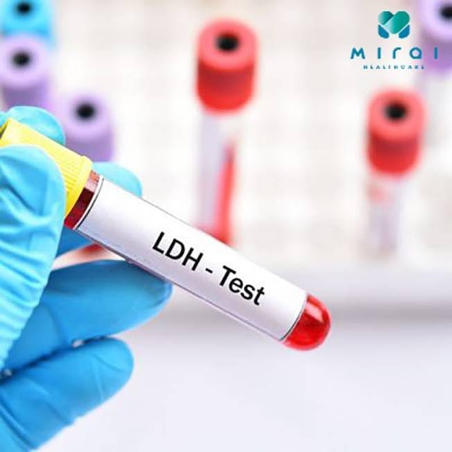 xet-nghiem-ldh-la-gi-thumbnail