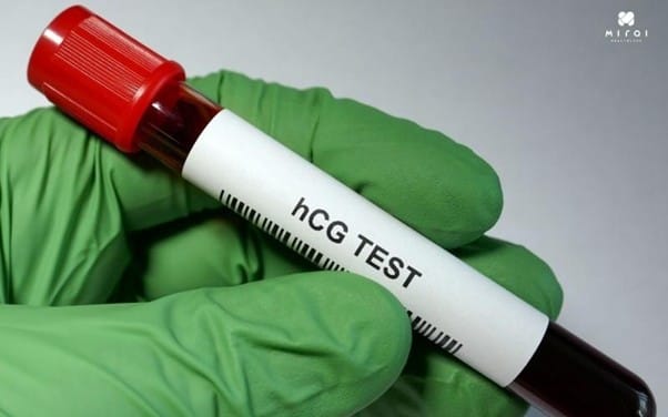 xet-nghiem-mau-biet-co-thai-khong