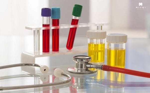 xet-nghiem-mau-co-biet-suy-than-khong