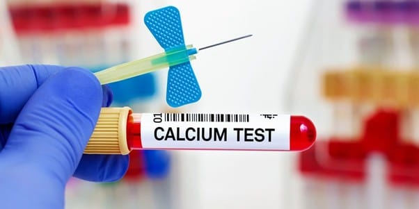 xet-nghiem-mau-co-biet-thieu-canxi-khong