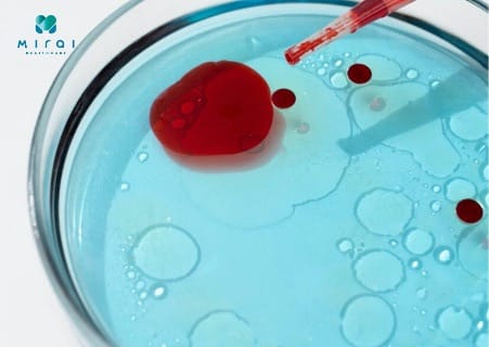 xet-nghiem-mau-co-phat-hien-ung-thu-mau-khong