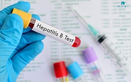 xet-nghiem-mau-co-phat-hien-viem-gan-b-khong