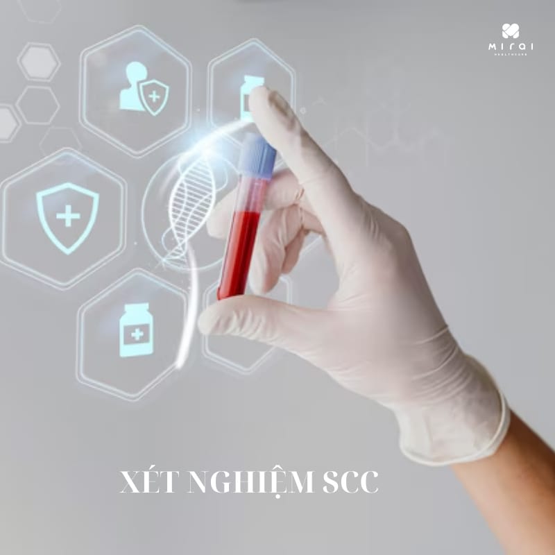 xet-nghiem-scc-la-gi-thumbnail