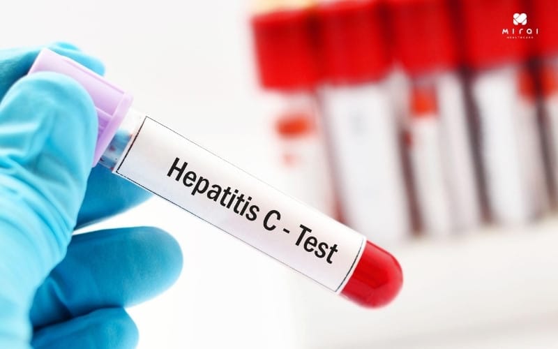 xet-nghiem-viem-gan-c-bao-nhieu-tien